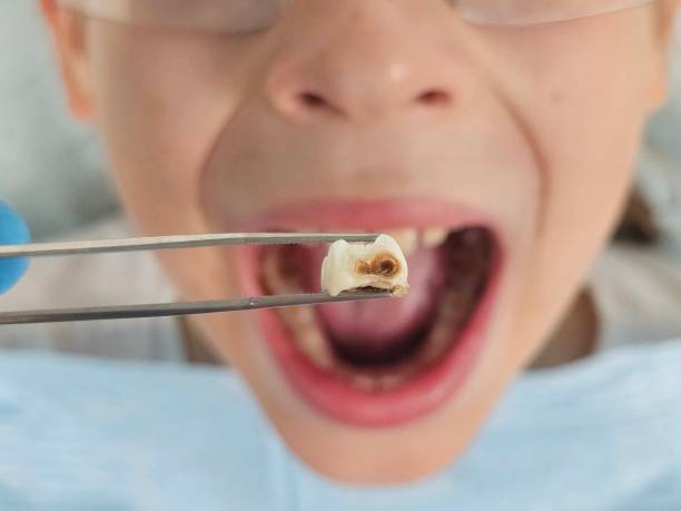 Best Cracked Tooth Emergency Dentist  in Cornwells Heights, PA